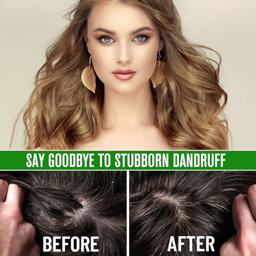 2PCS Rosemary Oil for Hair Growth Organic - 100% Pure Rosemary Oil for Eyebrow and Eyelash - Biotin and Essential Oils Y9778