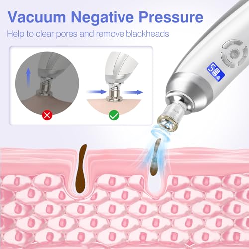Diamond Micro-dermabrasion Machine G3715