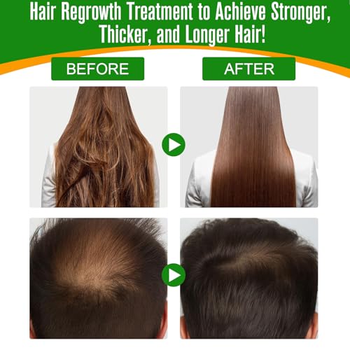2PCS Rosemary Oil for Hair Growth Organic - 100% Pure Rosemary Oil for Eyebrow and Eyelash - Biotin and Essential Oils Y9778